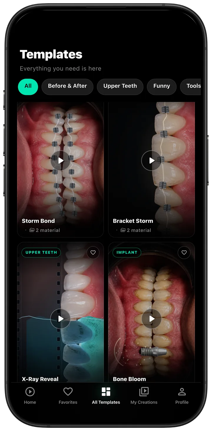 DentalReels template library with before/after, upper teeth and braces categories