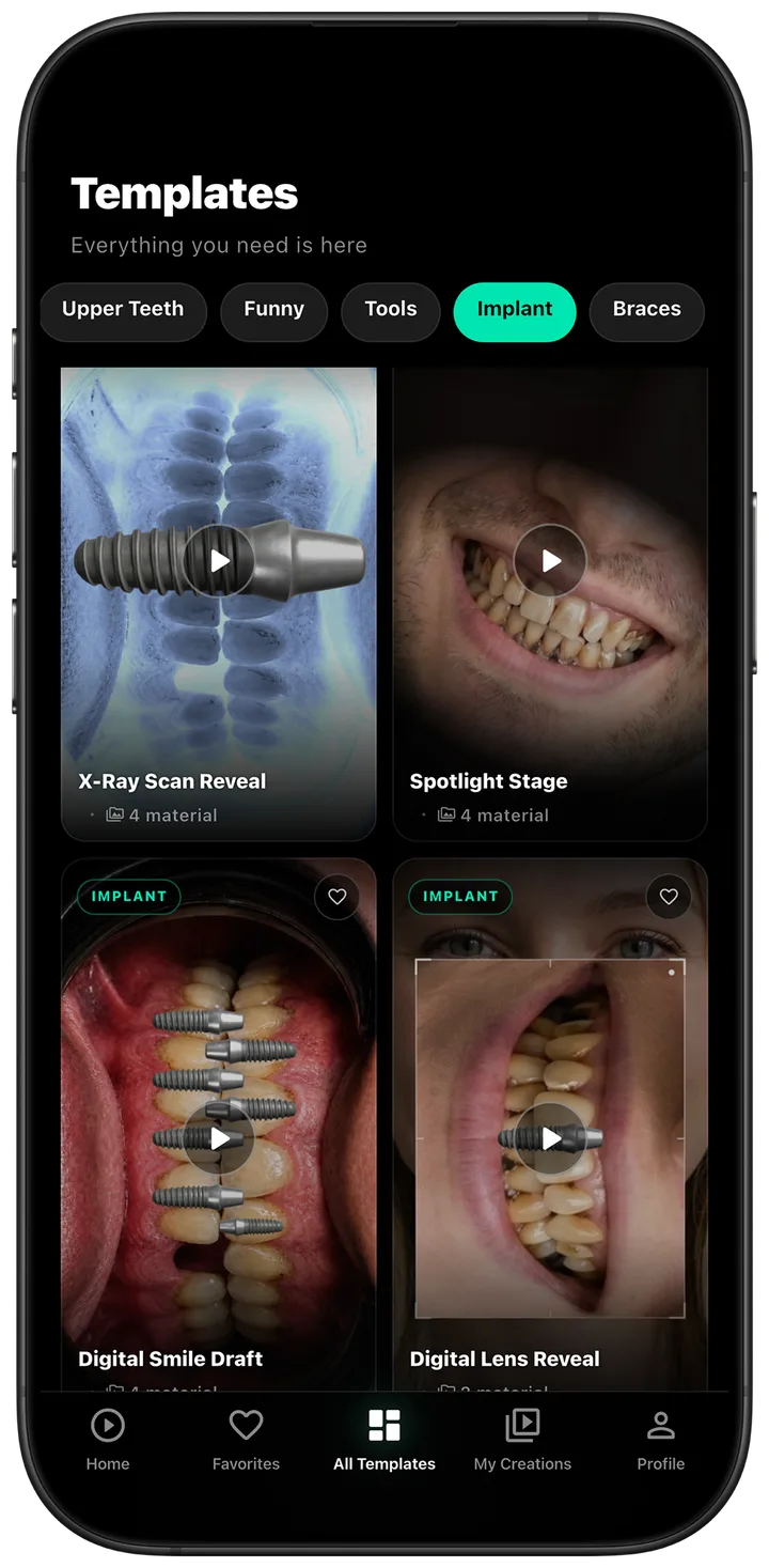 Implant video templates including X-Ray Scan Reveal and Digital Smile Draft