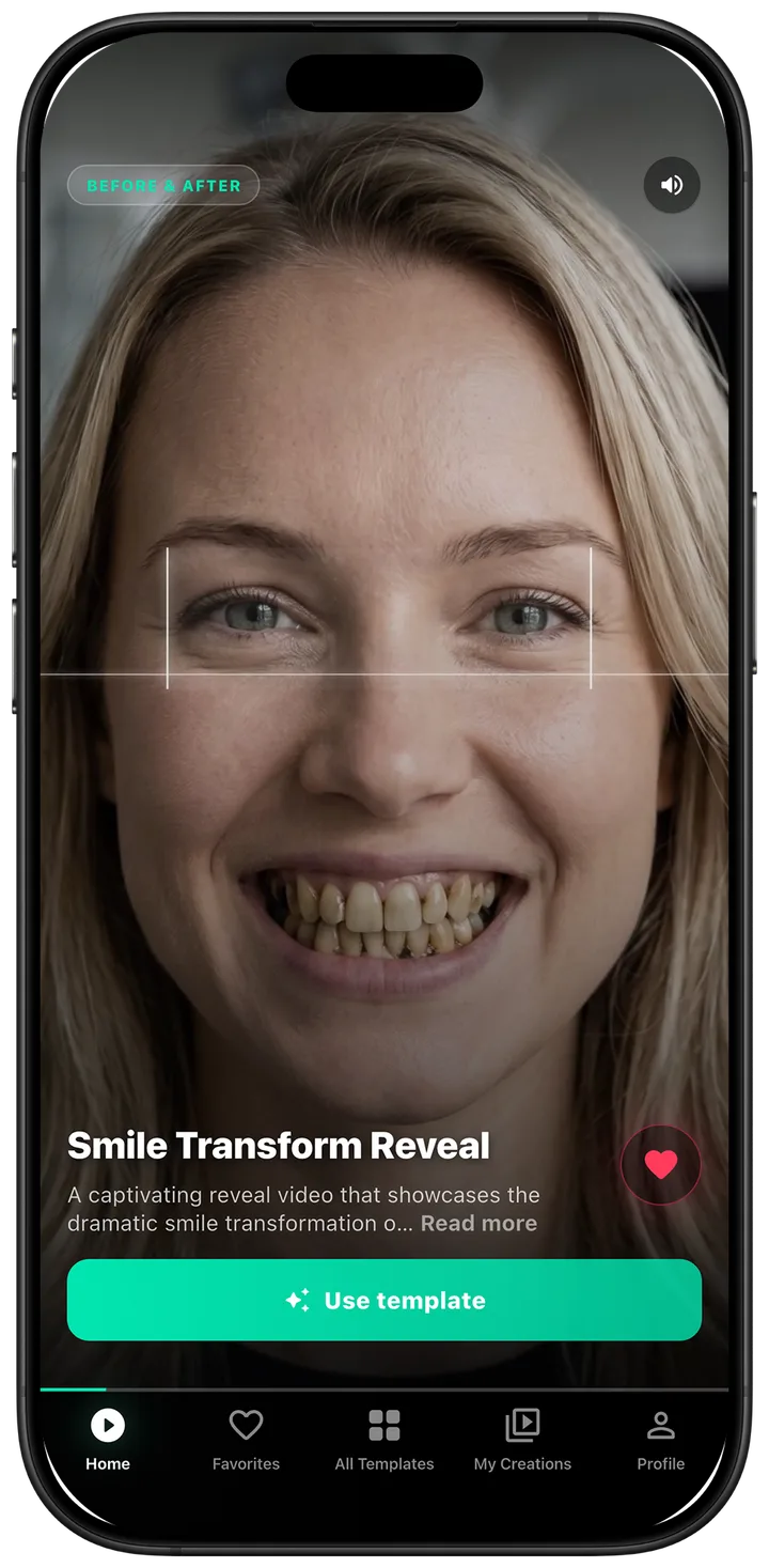 DentalReels home feed showing the Smile Transform Reveal template
